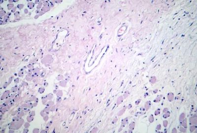 Advances in Medicine Every Gastroenterologist Wants You to Know